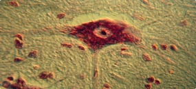 Osteoblast Kemik Hücresi