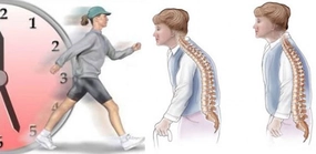 Kemik Erimesi Belirtileri ve Tedavisi