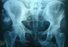 Sakroiliak Eklem Özellikleri